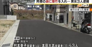 【暴行】同僚の尻にライターで着火、鼻に爆竹入れ爆発させた女ら3人逮捕