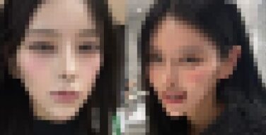 【画像】整形、ガチで美人を生み出しまくっていた