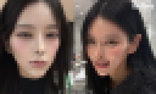 【画像】整形、ガチで美人を生み出しまくっていた